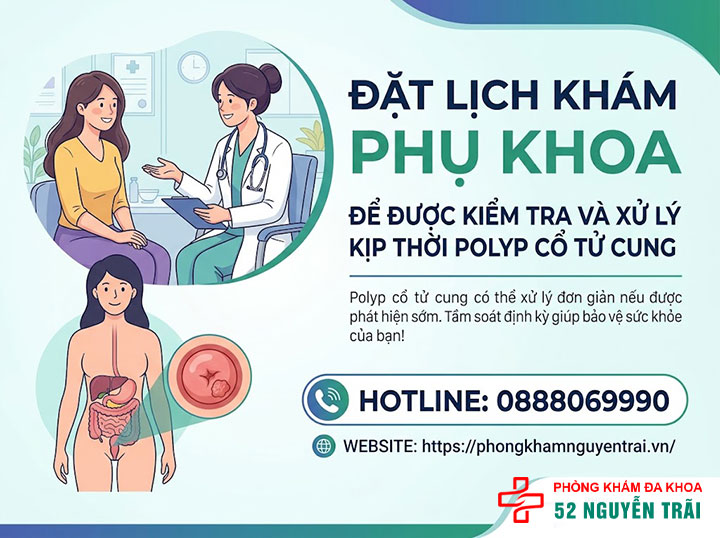 Polyp Cổ Tử Cung Là Gì? Nguyên Nhân, Triệu Chứng Đầy Đủ 9 Đặt lịch khám phụ khoa để được kiểm tra và xử lý kịp thời Polyp cổ tử cung