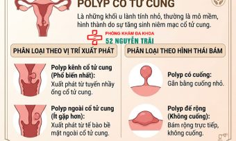 Polyp Cổ Tử Cung Là Gì? Nguyên Nhân, Triệu Chứng Đầy Đủ