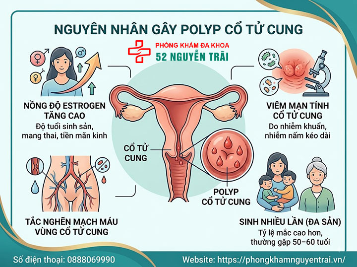 Polyp Cổ Tử Cung Là Gì? Nguyên Nhân, Triệu Chứng Đầy Đủ 3 Nguyên nhân gây polyp cổ tử cung