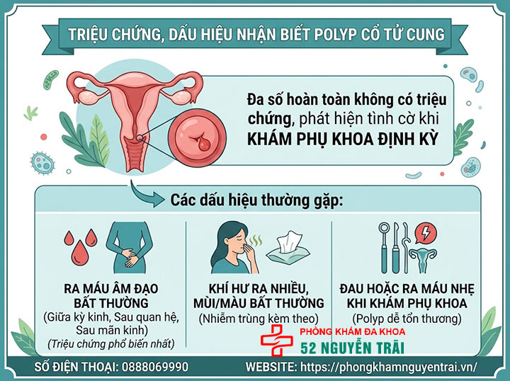 Polyp Cổ Tử Cung Là Gì? Nguyên Nhân, Triệu Chứng Đầy Đủ 4 Triệu chứng, dấu hiệu nhận biết polyp cổ tử cung