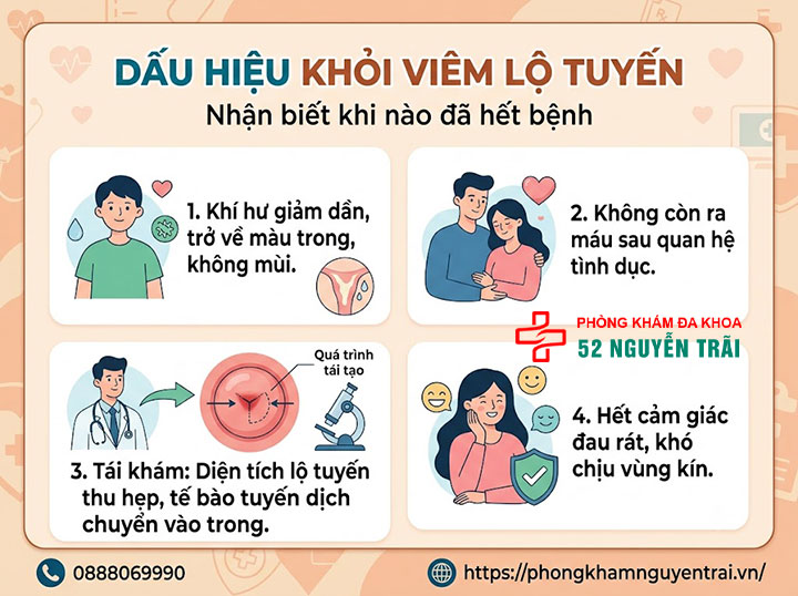 Viêm Lộ Tuyến Cổ Tử Cung Là Gì? Dấu Hiệu, Cấp Độ 5 Dấu hiệu khỏi viêm lộ tuyến – nhận biết khi nào đã hết bệnh