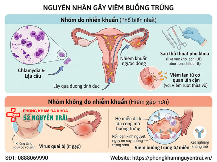 Viêm Buồng Trứng: Triệu Chứng, Nguyên Nhân Đầy Đủ 2 Nguyên nhân gây viêm buồng trứng