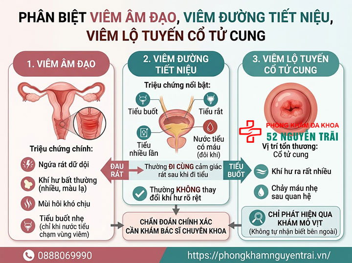 Viêm Âm Đạo Là Gì? Triệu Chứng, Nguyên Nhân Đầy Đủ 6 Phân biệt viêm âm đạo với viêm đường tiết niệu và viêm lộ tuyến cổ tử cung