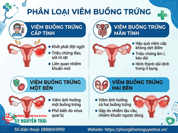 Viêm Buồng Trứng: Triệu Chứng, Nguyên Nhân Đầy Đủ 4 Phân loại viêm buồng trứng: cấp tính, mãn tính, một bên, hai bên