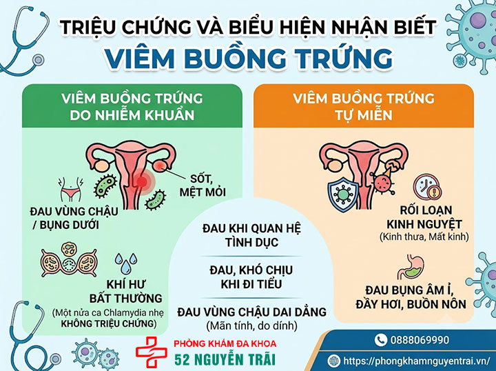 Viêm Buồng Trứng: Triệu Chứng, Nguyên Nhân Đầy Đủ 3 Triệu chứng và biểu hiện nhận biết viêm buồng trứng