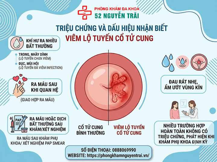Viêm Lộ Tuyến Cổ Tử Cung Là Gì? Dấu Hiệu, Cấp Độ 4 Triệu chứng và dấu hiệu nhận biết viêm lộ tuyến cổ tử cung