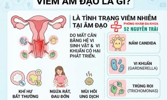 Viêm Âm Đạo Là Gì? Triệu Chứng, Nguyên Nhân Đầy Đủ