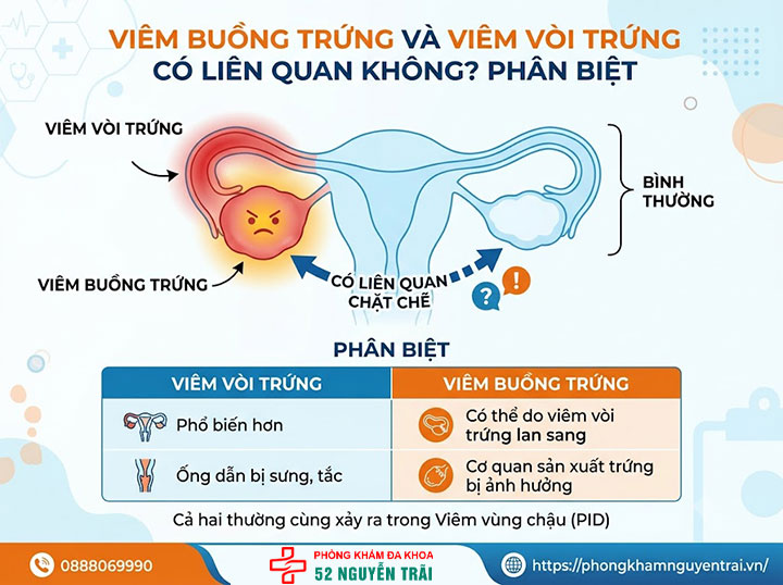 Viêm Buồng Trứng: Triệu Chứng, Nguyên Nhân Đầy Đủ 5 Viêm buồng trứng có liên quan đến viêm vòi trứng không? Phân biệt