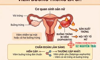 Viêm Buồng Trứng: Triệu Chứng, Nguyên Nhân Đầy Đủ