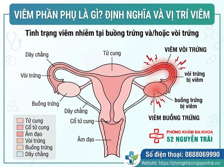 Viêm Phần Phụ Là Gì? Triệu Chứng, Nguyên Nhân 1 Viêm phần phụ là gì? Định nghĩa và vị trí viêm