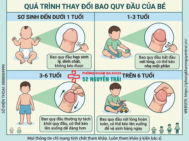 5 Sai Lầm Cha Mẹ Hay Mắc Khi Nong Bao Quy Đầu Cho Bé 1 Bao quy đầu của bé thay đổi như thế nào theo từng giai đoạn tuổi?