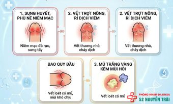 Loét Bao Quy Đầu: Nguyên Nhân Và Cách Điều Trị