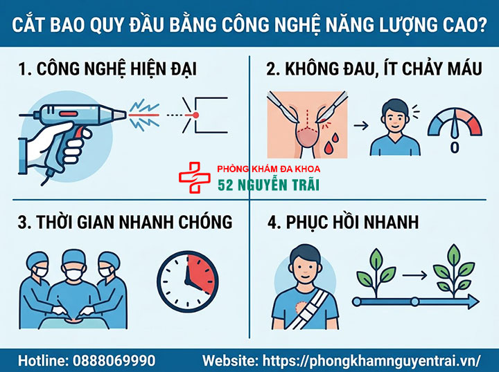Phẫu thuật dài bao quy đầu: Các phương pháp và quy trình an toàn 3 Cắt bao quy đầu bằng công nghệ năng lượng cao