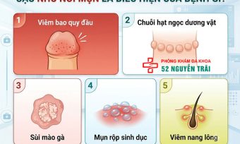 Cậu nhỏ nổi mụn: Dấu hiệu cảnh báo bệnh nam khoa nguy hiểm