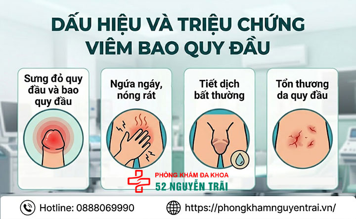 Viêm bao quy đầu: Nguyên nhân, dấu hiệu và cách điều trị 3 Dấu hiệu và triệu chứng viêm bao quy đầu