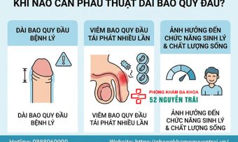 Phẫu thuật dài bao quy đầu: Các phương pháp và quy trình an toàn