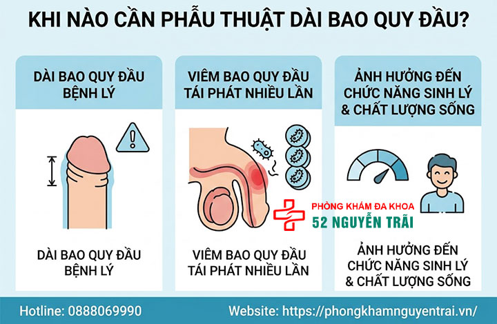 Phẫu thuật dài bao quy đầu: Các phương pháp và quy trình an toàn 1 Khi nào cần phẫu thuật dài bao quy đầu