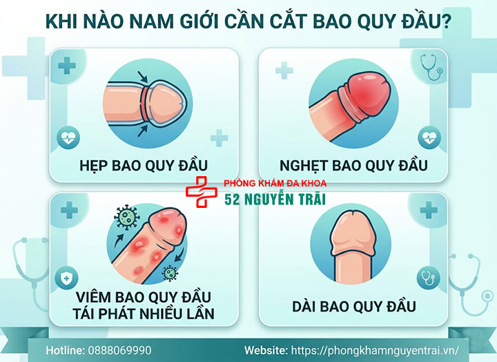 Cắt Bao Quy Đầu Cho Trẻ: Khi Nào Cần Và Độ Tuổi Phù Hợp 9 Khi nào nam giới cần cắt bao quy đầu