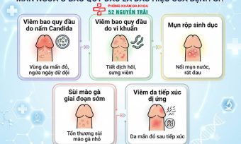 Mẩn ngứa ở bao quy đầu: Nhận biết sớm và phòng ngừa hiệu quả