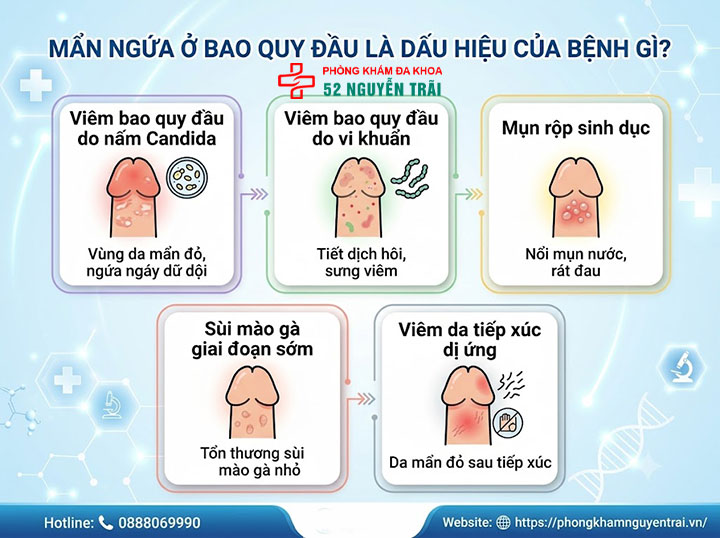 Mẩn ngứa ở bao quy đầu: Nhận biết sớm và phòng ngừa hiệu quả 1 Mẩn ngứa ở bao quy đầu là dấu hiệu của bệnh gì