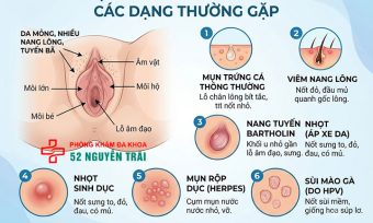 Mụn Ở Vùng Kín Nữ Có Nguy Hiểm Không? Bác Sĩ Giải Đáp