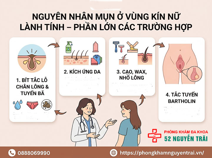 Mụn Ở Vùng Kín Nữ Có Nguy Hiểm Không? Bác Sĩ Giải Đáp 2 Nguyên nhân Mụn Ở Vùng Kín Nữ lành tính