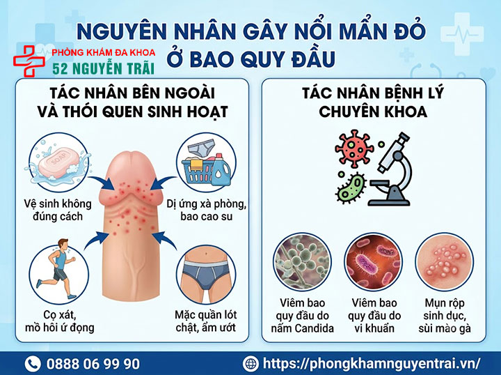 Nổi mẩn đỏ ở bao quy đầu: Khám ở đâu uy tín Hà Nội? 1 Nguyên nhân gây nổi mẩn đỏ ở bao quy đầu