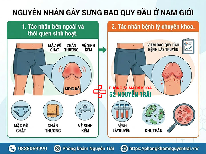 Sưng bao quy đầu do đâu? Nguyên nhân và cách xử lý an toàn 1 Nguyên nhân gây sưng bao quy đầu ở nam giới