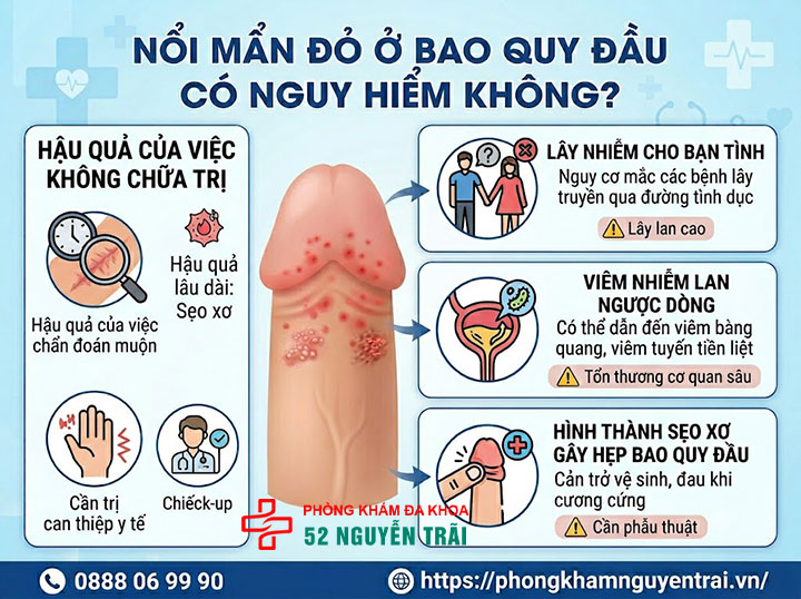 Nổi mẩn đỏ ở bao quy đầu: Khám ở đâu uy tín Hà Nội? 4 Nổi mẩn đỏ ở bao quy đầu có nguy hiểm không?