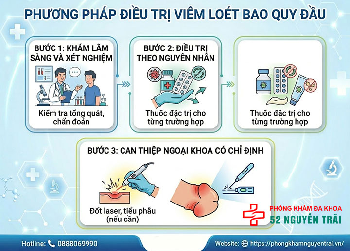 Loét Bao Quy Đầu: Nguyên Nhân Và Cách Điều Trị 4 Phương Pháp Điều Trị Viêm Loét Bao Quy Đầu