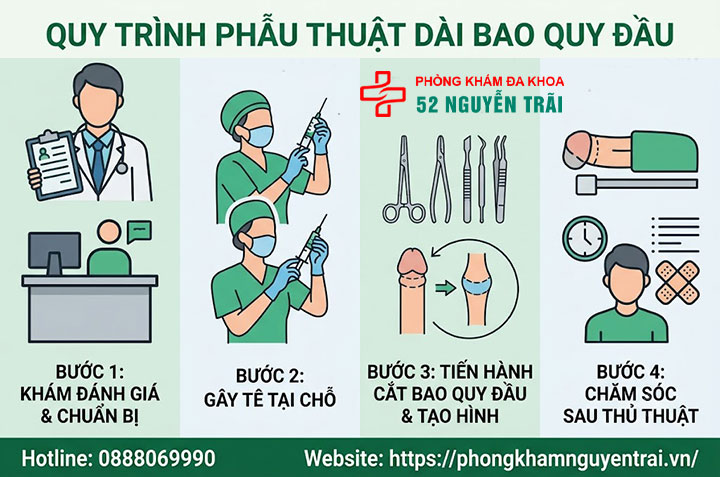 Phẫu thuật dài bao quy đầu: Các phương pháp và quy trình an toàn 5 Quy trình phẫu thuật dài bao quy đầu