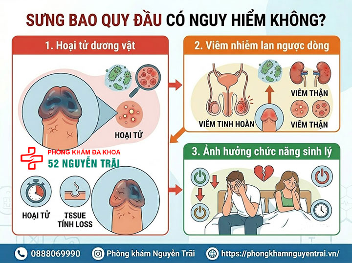 Sưng bao quy đầu do đâu? Nguyên nhân và cách xử lý an toàn 5 Sưng bao quy đầu có nguy hiểm không
