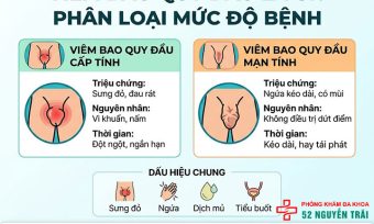 Viêm bao quy đầu: Nguyên nhân, dấu hiệu và cách điều trị