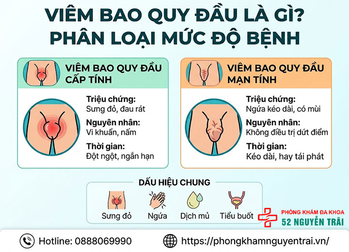 Viêm bao quy đầu: Nguyên nhân, dấu hiệu và cách điều trị 1 viêm bao quy đầu là gì