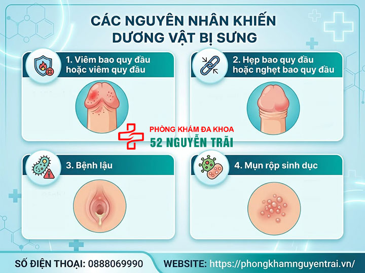 Dương vật bị sưng: Nguyên nhân, dấu hiệu và cách xử lý an toàn 2 Các nguyên nhân khiến dương vật bị sưng