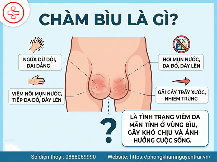Bệnh Chàm Bìu: Nguyên Nhân, Triệu Chứng Và Điều Trị 1 Chàm bìu là gì?