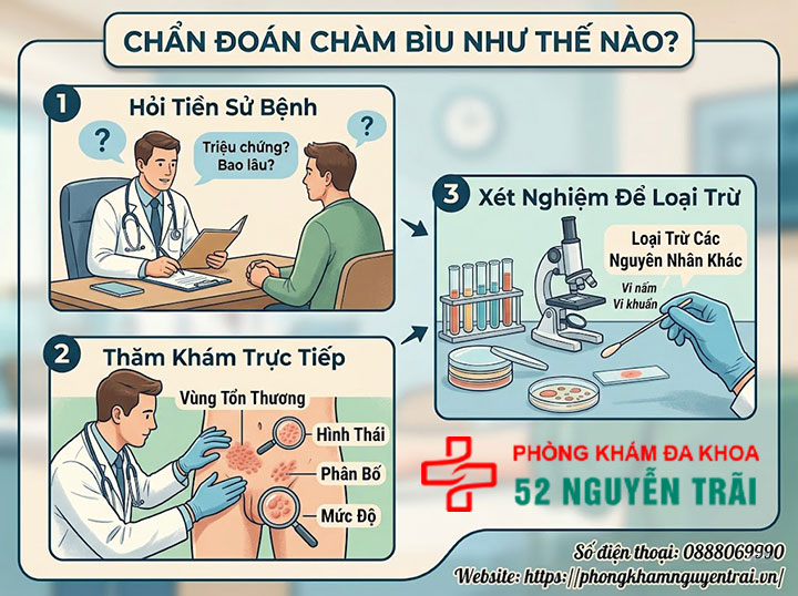 Bệnh Chàm Bìu: Nguyên Nhân, Triệu Chứng Và Điều Trị 6 Chẩn đoán chàm bìu như thế nào?