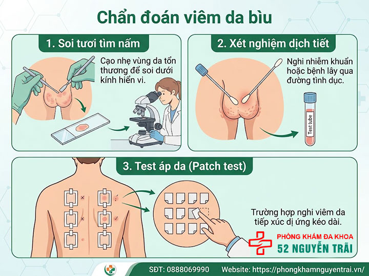 Viêm Da Bìu Là Gì? Nguyên Nhân Và Cách Điều Trị 5 Chẩn đoán viêm da bìu