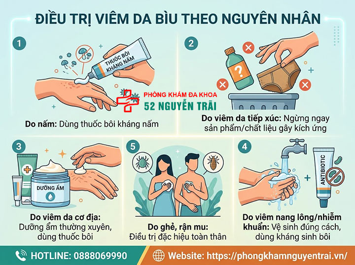 Viêm Da Bìu Là Gì? Nguyên Nhân Và Cách Điều Trị 6 Điều trị viêm da bìu theo nguyên nhân