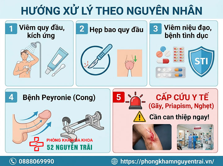 Đau Tức Dương Vật: Nguyên Nhân Và Khi Nào Cần Đi Khám 6 Hướng xử lý theo nguyên nhân đau tức dương vật