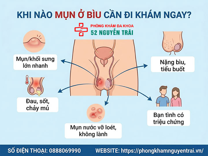 Bìu Nổi Mụn: Nguyên Nhân Và Khi Nào Cần Đi Khám 3 Khi nào mụn ở bìu là dấu hiệu cần đi khám ngay?