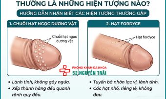 Mụn Thịt Ở Vùng Kín Nam Là Gì? Có Nguy Hiểm Không?
