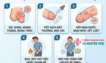 Ngứa Dương Vật: Nguyên Nhân Và Cách Xử Lý Đúng