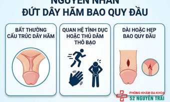 Đứt dây hãm bao quy đầu: Nguyên nhân, cách sơ cứu và điều trị