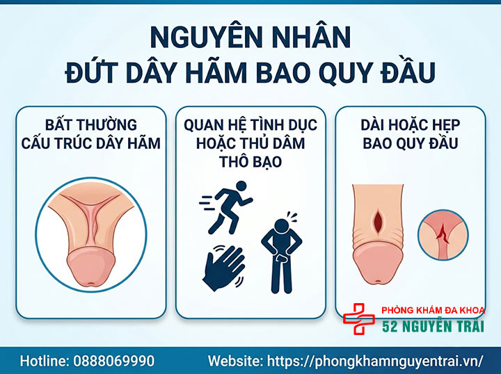 Đứt dây hãm bao quy đầu: Nguyên nhân, cách sơ cứu và điều trị 1 Nguyên nhân đứt dây hãm bao quy đầu