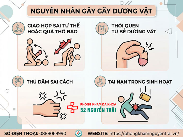 Gãy dương vật: Triệu chứng nguy hiểm và cách xử lý khẩn cấp 3 Nguyên nhân gây gãy dương vật