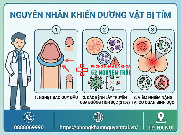 Dương vật bị tím: Nguyên nhân bầm tím và cách xử lý khẩn cấp 2 Nguyên nhân khiến dương vật bị tím
