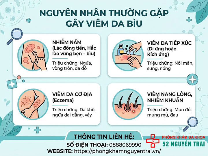 Viêm Da Bìu Là Gì? Nguyên Nhân Và Cách Điều Trị 2 Nguyên nhân thường gặp gây viêm da bìu