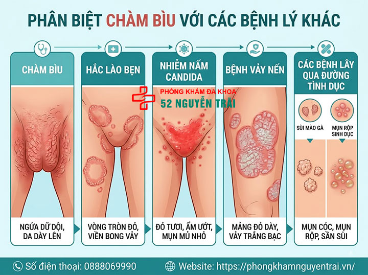 Bệnh Chàm Bìu: Nguyên Nhân, Triệu Chứng Và Điều Trị 5 Phân biệt chàm bìu với các bệnh lý khác