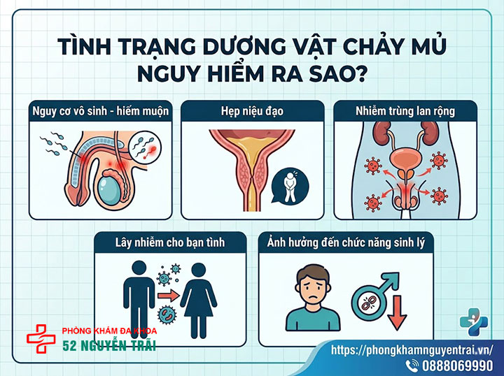 Dương vật chảy mủ: Nguyên nhân, biến chứng và cách điều trị 3 Tình trạng dương vật chảy mủ nguy hiểm ra sao?